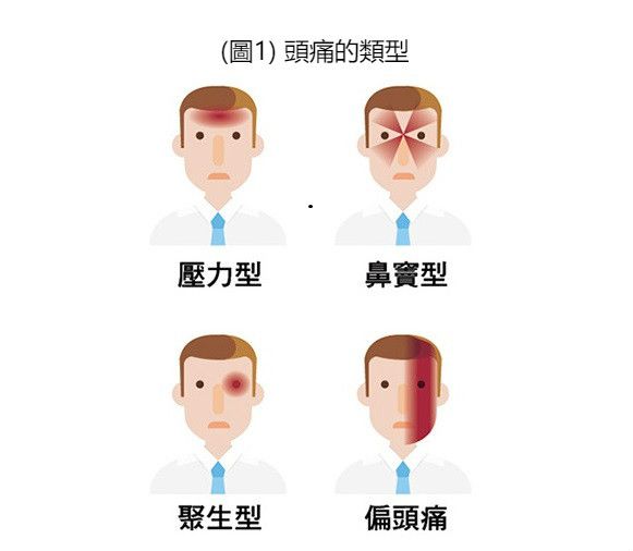 根据疼痛的特征部位,又可再细分出许多亚型,例如压力型,鼻窦型,聚生型